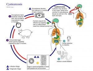 Cysticercosis_by_Taenia_solium_PHIL_3387_lores