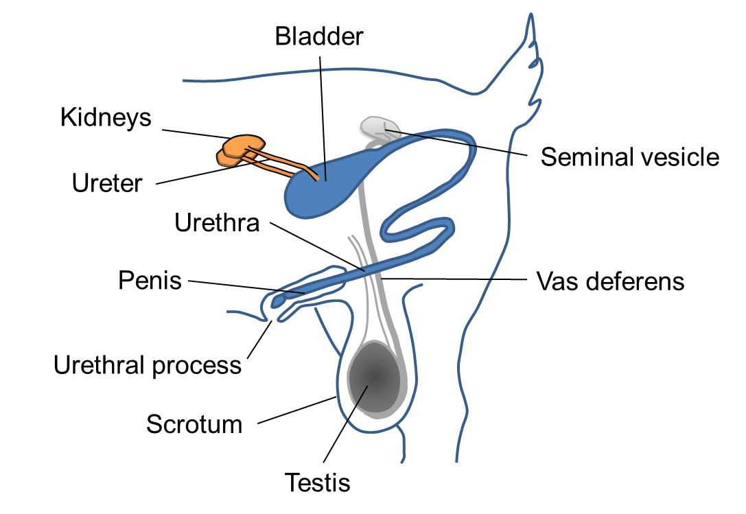 pictures of kidney stones in the bladder